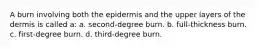 A burn involving both the epidermis and the upper layers of the dermis is called a: a. second-degree burn. b. full-thickness burn. c. first-degree burn. d. third-degree burn.