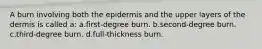 A burn involving both the epidermis and the upper layers of the dermis is called a: a.first-degree burn. b.second-degree burn. c.third-degree burn. d.full-thickness burn.