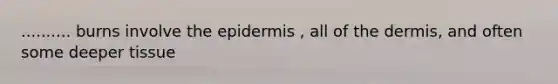 .......... burns involve the epidermis , all of the dermis, and often some deeper tissue