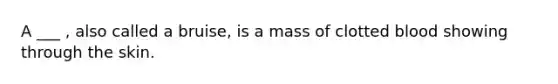 A ___ , also called a bruise, is a mass of clotted blood showing through the skin.