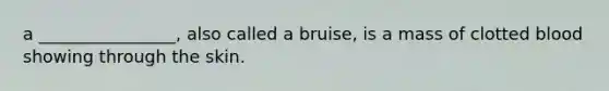 a ________________, also called a bruise, is a mass of clotted blood showing through the skin.