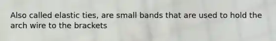 Also called elastic ties, are small bands that are used to hold the arch wire to the brackets