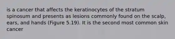 is a cancer that affects the keratinocytes of the stratum spinosum and presents as lesions commonly found on the scalp, ears, and hands (Figure 5.19). It is the second most common skin cancer