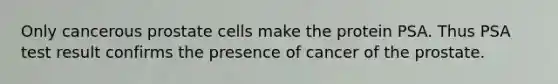 Only cancerous prostate cells make the protein PSA. Thus PSA test result confirms the presence of cancer of the prostate.