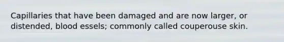 Capillaries that have been damaged and are now larger, or distended, blood essels; commonly called couperouse skin.