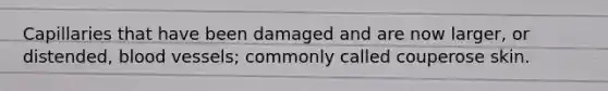Capillaries that have been damaged and are now larger, or distended, blood vessels; commonly called couperose skin.