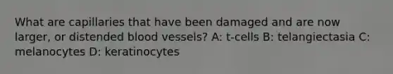 What are capillaries that have been damaged and are now larger, or distended blood vessels? A: t-cells B: telangiectasia C: melanocytes D: keratinocytes