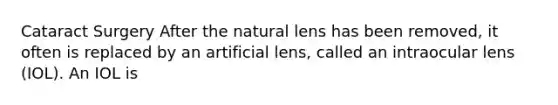 Cataract Surgery After the natural lens has been removed, it often is replaced by an artificial lens, called an intraocular lens (IOL). An IOL is