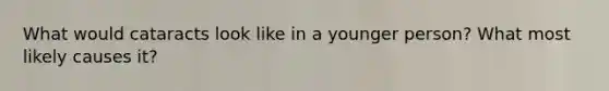 What would cataracts look like in a younger person? What most likely causes it?