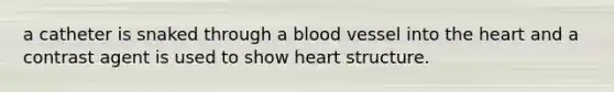 a catheter is snaked through a blood vessel into <a href='https://www.questionai.com/knowledge/kya8ocqc6o-the-heart' class='anchor-knowledge'>the heart</a> and a contrast agent is used to show heart structure.