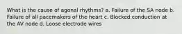 What is the cause of agonal rhythms? a. Failure of the SA node b. Failure of all pacemakers of the heart c. Blocked conduction at the AV node d. Loose electrode wires