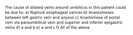The cause of dilated veins around umbilicus in this patient could be due to; a) Rupture esophageal varices b) Anastomoses between left gastric vein and azyous c) Anastomose of portal vein via paraumbilical vein and superior and inferior epigastric veins d) a and b e) a and c f) All of the above
