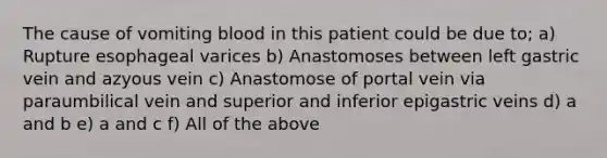 The cause of vomiting blood in this patient could be due to; a) Rupture esophageal varices b) Anastomoses between left gastric vein and azyous vein c) Anastomose of portal vein via paraumbilical vein and superior and inferior epigastric veins d) a and b e) a and c f) All of the above