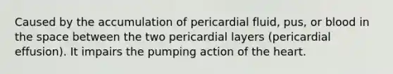 Caused by the accumulation of pericardial fluid, pus, or blood in the space between the two pericardial layers (pericardial effusion). It impairs the pumping action of the heart.