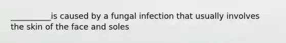 __________is caused by a fungal infection that usually involves the skin of the face and soles