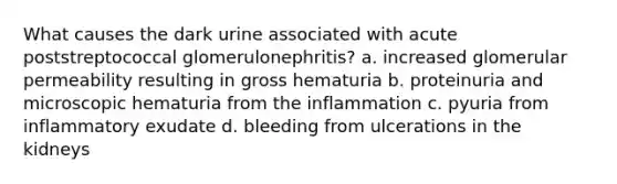 What causes the dark urine associated with acute poststreptococcal glomerulonephritis? a. increased glomerular permeability resulting in gross hematuria b. proteinuria and microscopic hematuria from the inflammation c. pyuria from inflammatory exudate d. bleeding from ulcerations in the kidneys