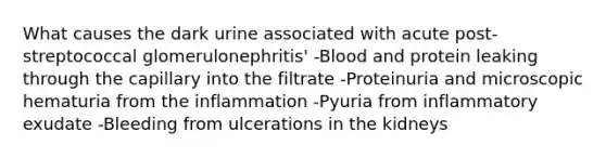 What causes the dark urine associated with acute post-streptococcal glomerulonephritis' -Blood and protein leaking through the capillary into the filtrate -Proteinuria and microscopic hematuria from the inflammation -Pyuria from inflammatory exudate -Bleeding from ulcerations in the kidneys