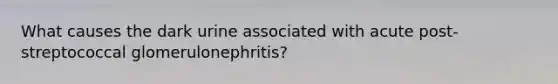 What causes the dark urine associated with acute post-streptococcal glomerulonephritis?