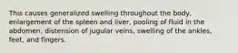 This causes generalized swelling throughout the body, enlargement of the spleen and liver, pooling of fluid in the abdomen, distension of jugular veins, swelling of the ankles, feet, and fingers.