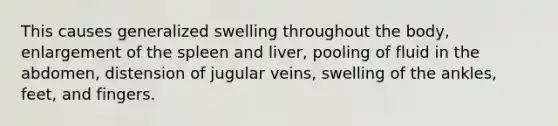 This causes generalized swelling throughout the body, enlargement of the spleen and liver, pooling of fluid in the abdomen, distension of jugular veins, swelling of the ankles, feet, and fingers.