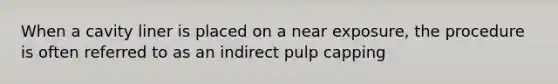 When a cavity liner is placed on a near exposure, the procedure is often referred to as an indirect pulp capping