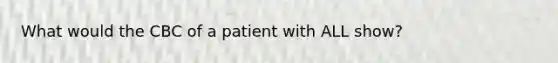 What would the CBC of a patient with ALL show?