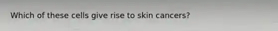Which of these cells give rise to skin cancers?