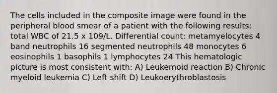 The cells included in the composite image were found in the peripheral blood smear of a patient with the following results: total WBC of 21.5 x 109/L. Differential count: metamyelocytes 4 band neutrophils 16 segmented neutrophils 48 monocytes 6 eosinophils 1 basophils 1 lymphocytes 24 This hematologic picture is most consistent with: A) Leukemoid reaction B) Chronic myeloid leukemia C) Left shift D) Leukoerythroblastosis