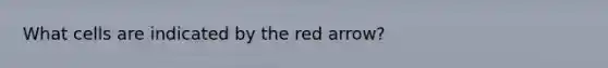 What cells are indicated by the red arrow?