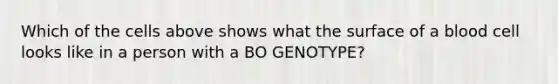 Which of the cells above shows what the surface of a blood cell looks like in a person with a BO GENOTYPE?