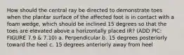 How should the central ray be directed to demonstrate toes when the plantar surface of the affected foot is in contact with a foam wedge, which should be inclined 15 degrees so that the toes are elevated above a horizontally placed IR? (ADD PIC: FIGURE 7.9 & 7.10) a. Perpendicular b. 15 degrees posteriorly toward the heel c. 15 degrees anteriorly away from heel