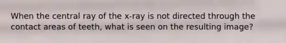 When the central ray of the x-ray is not directed through the contact areas of teeth, what is seen on the resulting image?