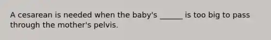 A cesarean is needed when the baby's ______ is too big to pass through the mother's pelvis.