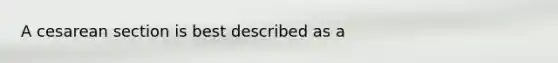 A cesarean section is best described as a