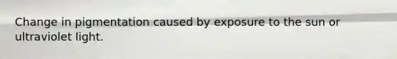 Change in pigmentation caused by exposure to the sun or ultraviolet light.
