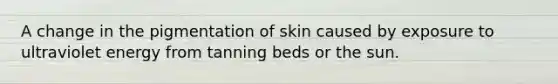 A change in the pigmentation of skin caused by exposure to ultraviolet energy from tanning beds or the sun.