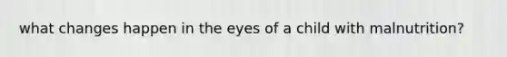 what changes happen in the eyes of a child with malnutrition?