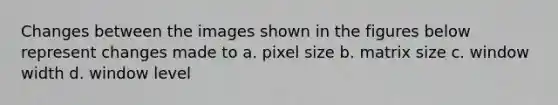 Changes between the images shown in the figures below represent changes made to a. pixel size b. matrix size c. window width d. window level