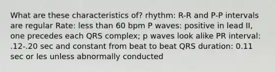 What are these characteristics of? rhythm: R-R and P-P intervals are regular Rate: less than 60 bpm P waves: positive in lead II, one precedes each QRS complex; p waves look alike PR interval: .12-.20 sec and constant from beat to beat QRS duration: 0.11 sec or les unless abnormally conducted