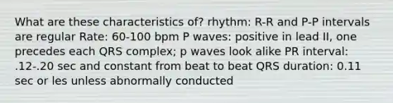 What are these characteristics of? rhythm: R-R and P-P intervals are regular Rate: 60-100 bpm P waves: positive in lead II, one precedes each QRS complex; p waves look alike PR interval: .12-.20 sec and constant from beat to beat QRS duration: 0.11 sec or les unless abnormally conducted