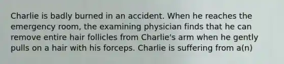 Charlie is badly burned in an accident. When he reaches the emergency room, the examining physician finds that he can remove entire hair follicles from Charlie's arm when he gently pulls on a hair with his forceps. Charlie is suffering from a(n)