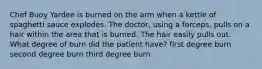 Chef Buoy Yardee is burned on the arm when a kettle of spaghetti sauce explodes. The doctor, using a forceps, pulls on a hair within the area that is burned. The hair easily pulls out. What degree of burn did the patient have? first degree burn second degree burn third degree burn