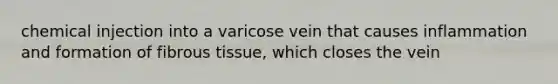 chemical injection into a varicose vein that causes inflammation and formation of fibrous tissue, which closes the vein