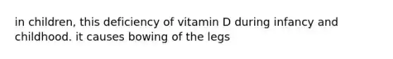 in children, this deficiency of vitamin D during infancy and childhood. it causes bowing of the legs