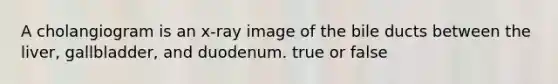 A cholangiogram is an x-ray image of the bile ducts between the liver, gallbladder, and duodenum. true or false