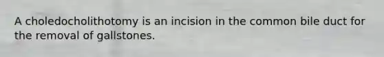 A choledocholithotomy is an incision in the common bile duct for the removal of gallstones.