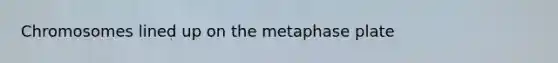 Chromosomes lined up on the metaphase plate