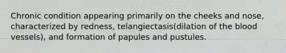 Chronic condition appearing primarily on the cheeks and nose, characterized by redness, telangiectasis(dilation of the blood vessels), and formation of papules and pustules.