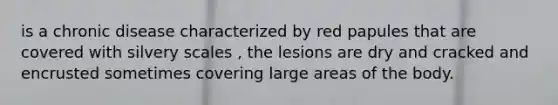 is a chronic disease characterized by red papules that are covered with silvery scales , the lesions are dry and cracked and encrusted sometimes covering large areas of the body.