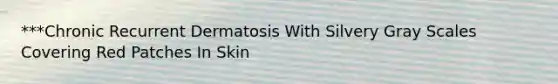 ***Chronic Recurrent Dermatosis With Silvery Gray Scales Covering Red Patches In Skin